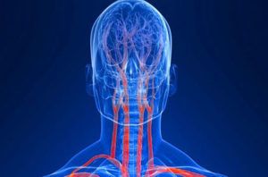 Контрастная ангиография артерий шеи в Волгограде ул. Пархоменко 1. 