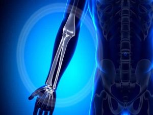 КТ области предплечья в Волгограде ул. Пархоменко 1. 