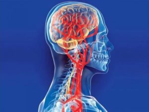 Контрастная ангиография артерий головы и шеи в Волгограде ул. Пархоменко 1. 