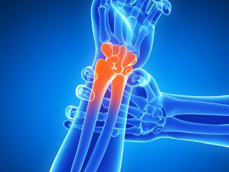 Компьютерная томография КТ лучезапястного сустава в Волгограде ул. Пархоменко 1 КТ лучезапястного сустава в Волгограде ул. Пархоменко 1.