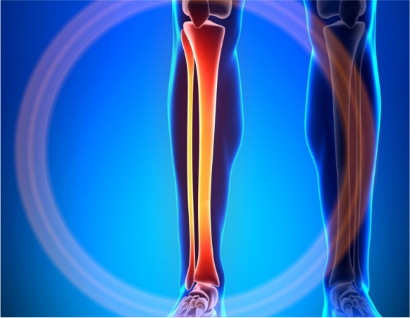 Компьютерная томография КТ области голени в Волгограде ул. Пархоменко 1 КТ области голени в Волгограде ул. Пархоменко 1.