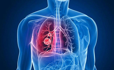 МРТ грудной клетки в Волгограде ул. Пархоменко 1. 