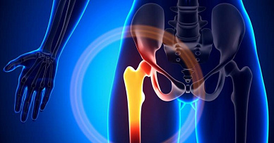 МРТ бедра в Волгограде ул. Пархоменко 1. 