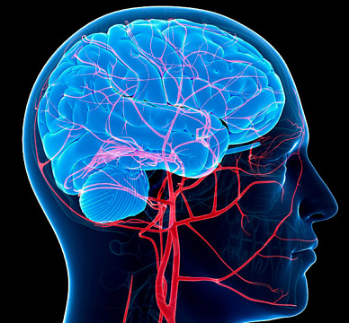 Контрастная ангиография артерий головного мозга в Волгограде ул. Пархоменко 1. 