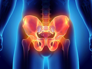 КТ костей таза в Волгограде ул. Пархоменко 1. 