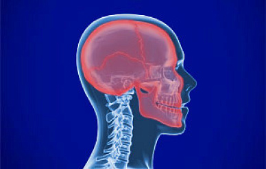 КТ костей черепа в Волгограде ул. Пархоменко 1. 