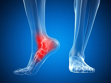 КТ голеностопного сустава в Волгограде ул. Пархоменко 1. 