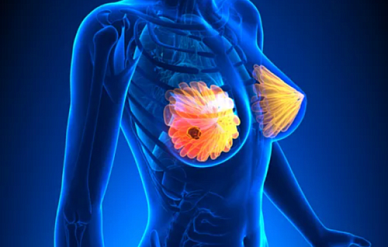 МРТ молочных желез в Волгограде ул. Пархоменко 1. 