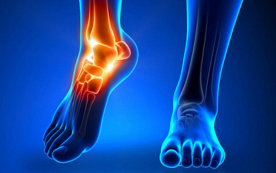 МРТ голеностопного сустава и стопы в Волгограде ул. Пархоменко 1. 