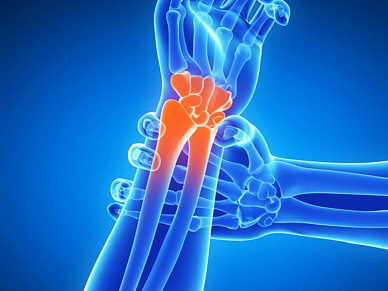 КТ лучезапястного сустава в Волгограде ул. Пархоменко 1. 