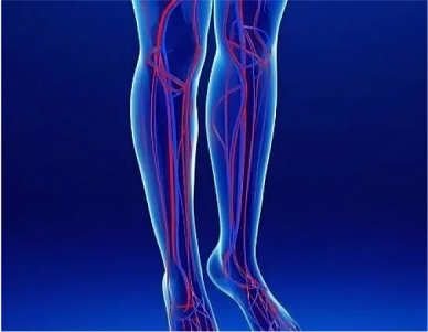 Контрастная ангиография артерий нижних конечностей от уровня брюшной аорты включительно в Волгограде ул. Пархоменко 1. 