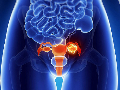КТ полости таза в Волгограде ул. Пархоменко 1. 