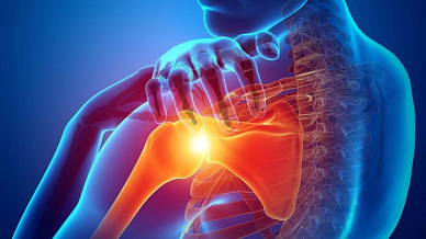 МРТ плечевого сустава в Волгограде ул. Пархоменко 1. 